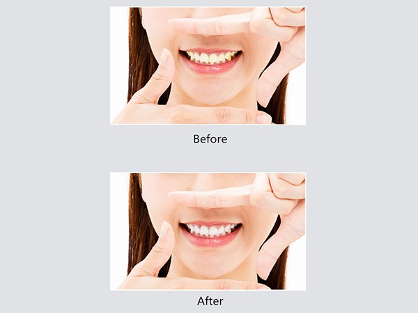 Cinco modos de escovar os dentes, adequados para todas as idades